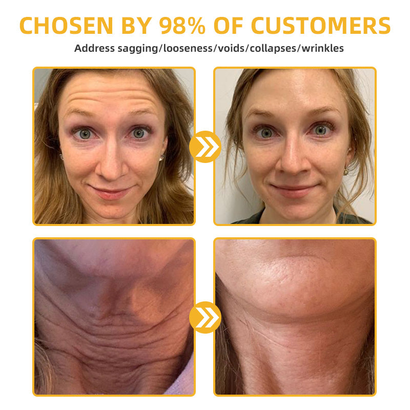 Bee Venom Retinol Skin Salve Ointment đŁBAD RECOMMENDS(đ„55% Off for a Limited Time!)