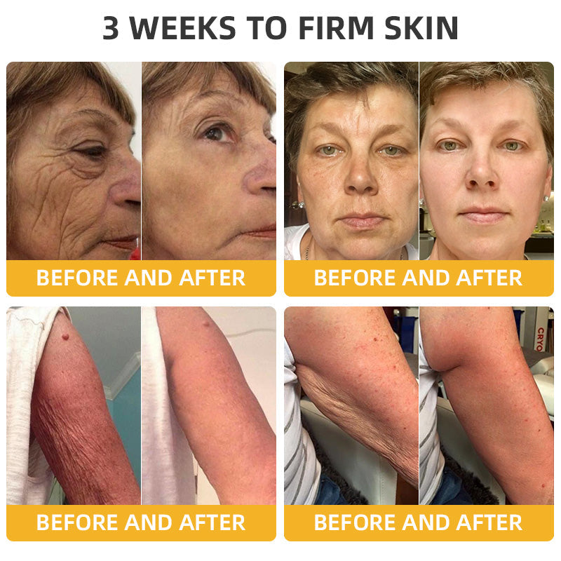 Bee Venom Retinol Skin Salve Ointment đŁBAD RECOMMENDS(đ„55% Off for a Limited Time!)