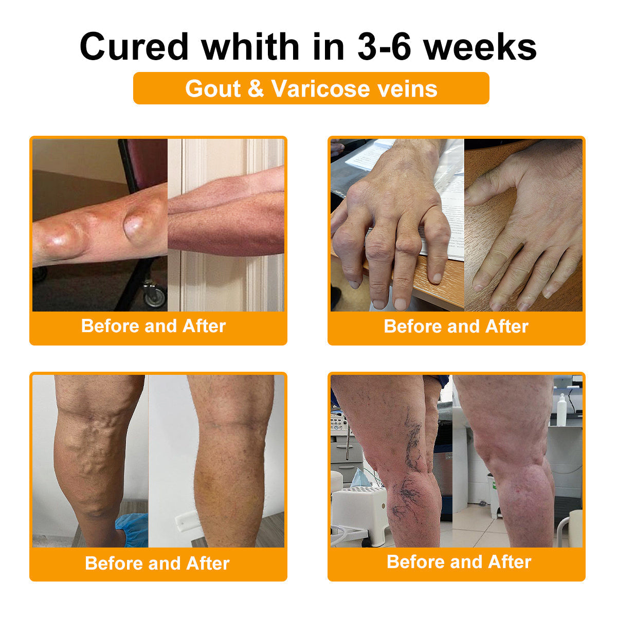 ✅TLOPA® Fájdalomcsillapító, csontregeneráló krém botulinum-toxinnal és méhméreggel 🐝