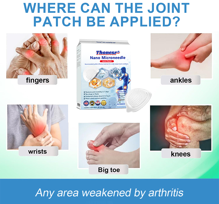 Official Store 🏃♀️ Recommended by AOA 💪Thonesr® Nano-microneedle joint patch (Painless, long-lasting, suitable for arthritis, varicose veins and various orthopedic diseases)【Last 30 min Flash Sale】