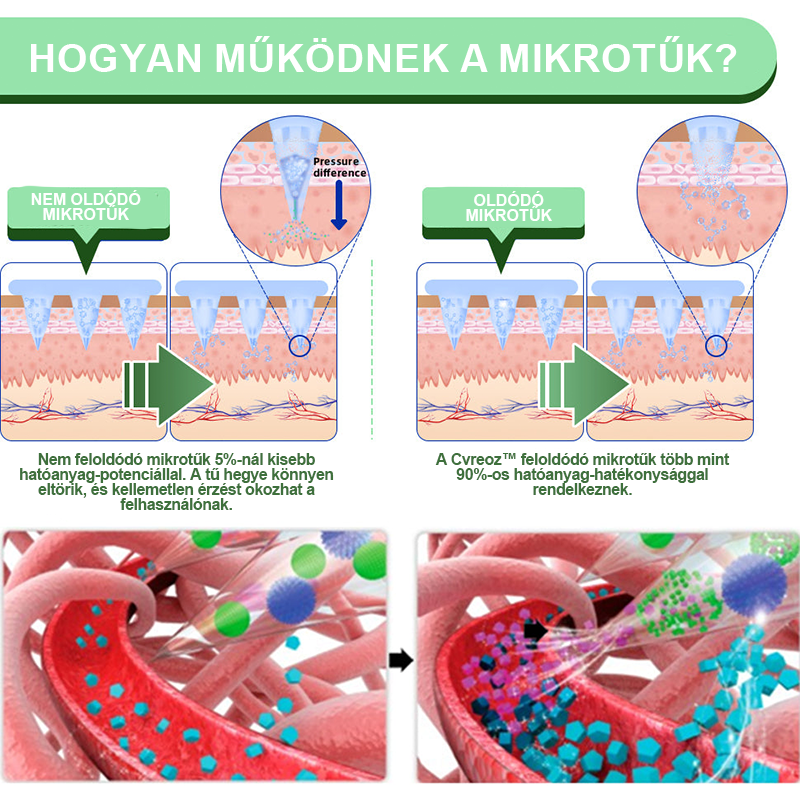 Cvreoz™ Smgt-Glp-1 Nano Microneedle Tapaszok (Fájdalommentes, hosszan tartó, a cukorbetegség, az elhízás és a szív- és érrendszeri betegségek kezelésére)👨⚕️