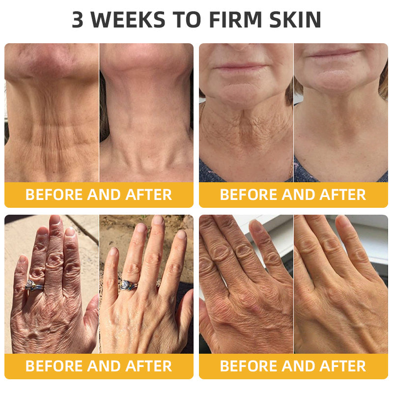 Bee Venom Retinol Skin Salve Ointment đŁBAD RECOMMENDS(đ„55% Off for a Limited Time!)