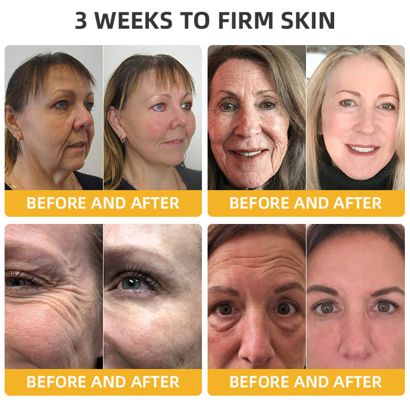 Bee Venom Retinol Skin Salve Ointment đŁBAD RECOMMENDS(đ„55% Off for a Limited Time!)