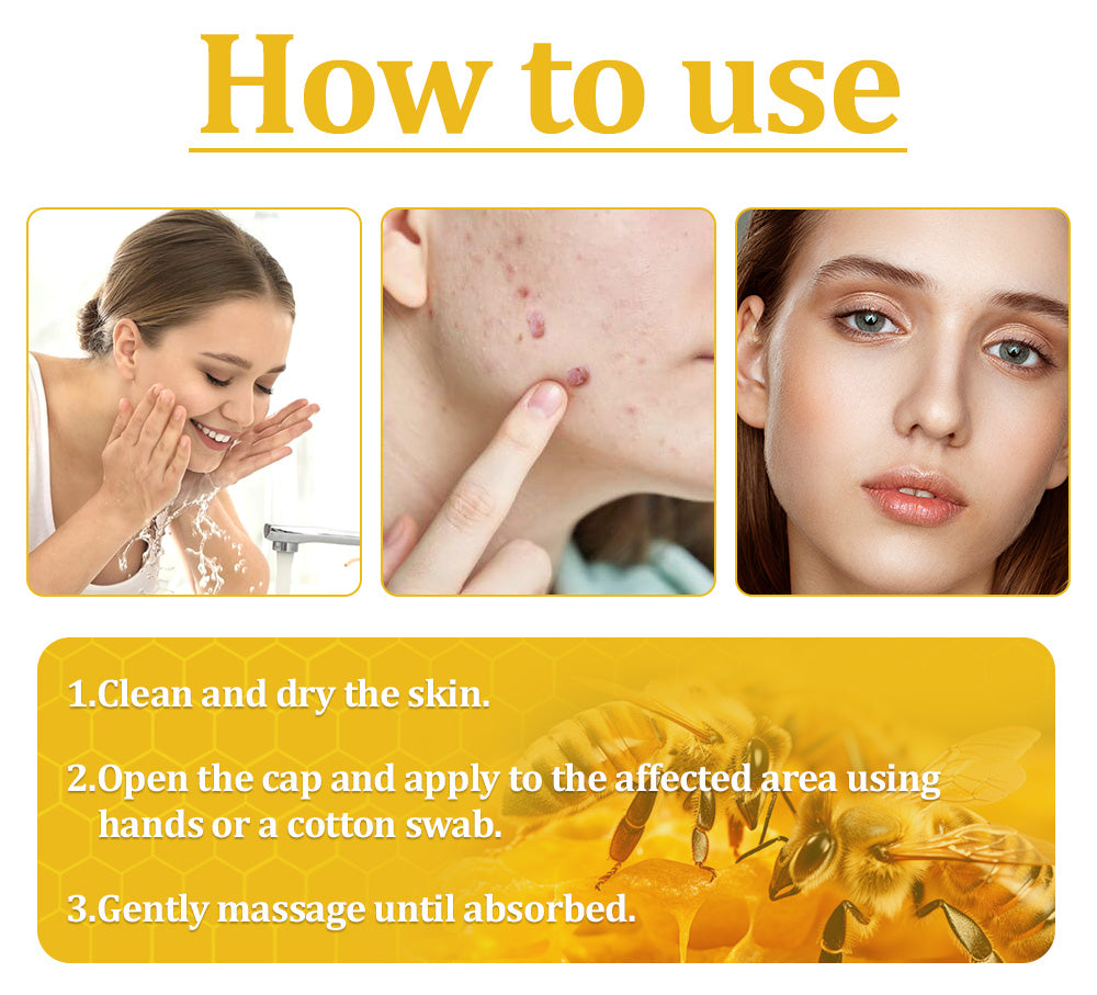 Turonuโข ๐๐๐ ๐๐๐ง๐จ๐ฆ ๐๐ค๐ข๐ง ๐๐ซ๐๐๐ญ๐ฆ๐๐ง๐ญ ๐๐ซ๐๐๐ฆ๐๏ผCDA ๐
๐๐๐๐๐๐๐๐๐๐๏ผ (โฐ๐ณ๐๐๐ ๐
๐๐ ๐๐๐๐๐๐๐๐๐ 80% ๐๐๐)