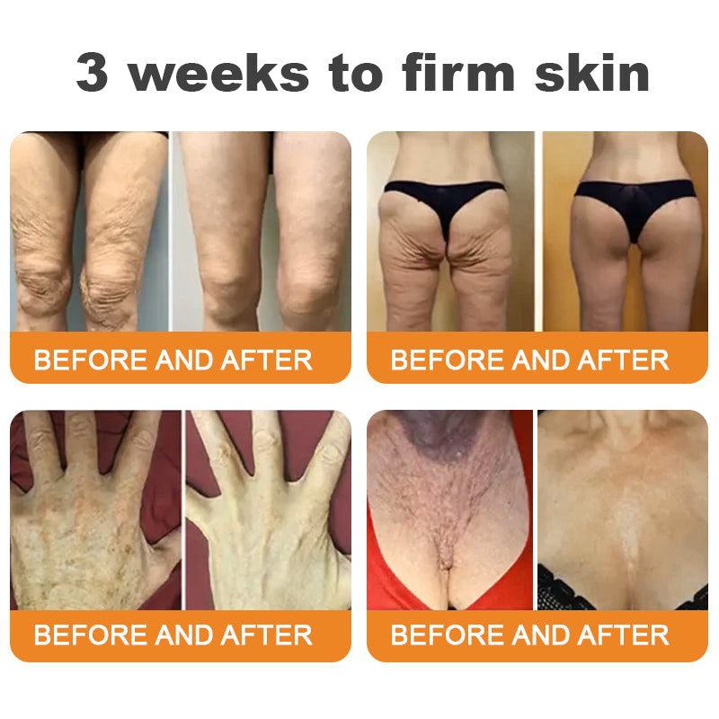 Made and Shipped from USA ✨ EQVP® Bee Venom Skin Restoration Cream ⏰ LAST DAY 80% OFF | 1.76 oz