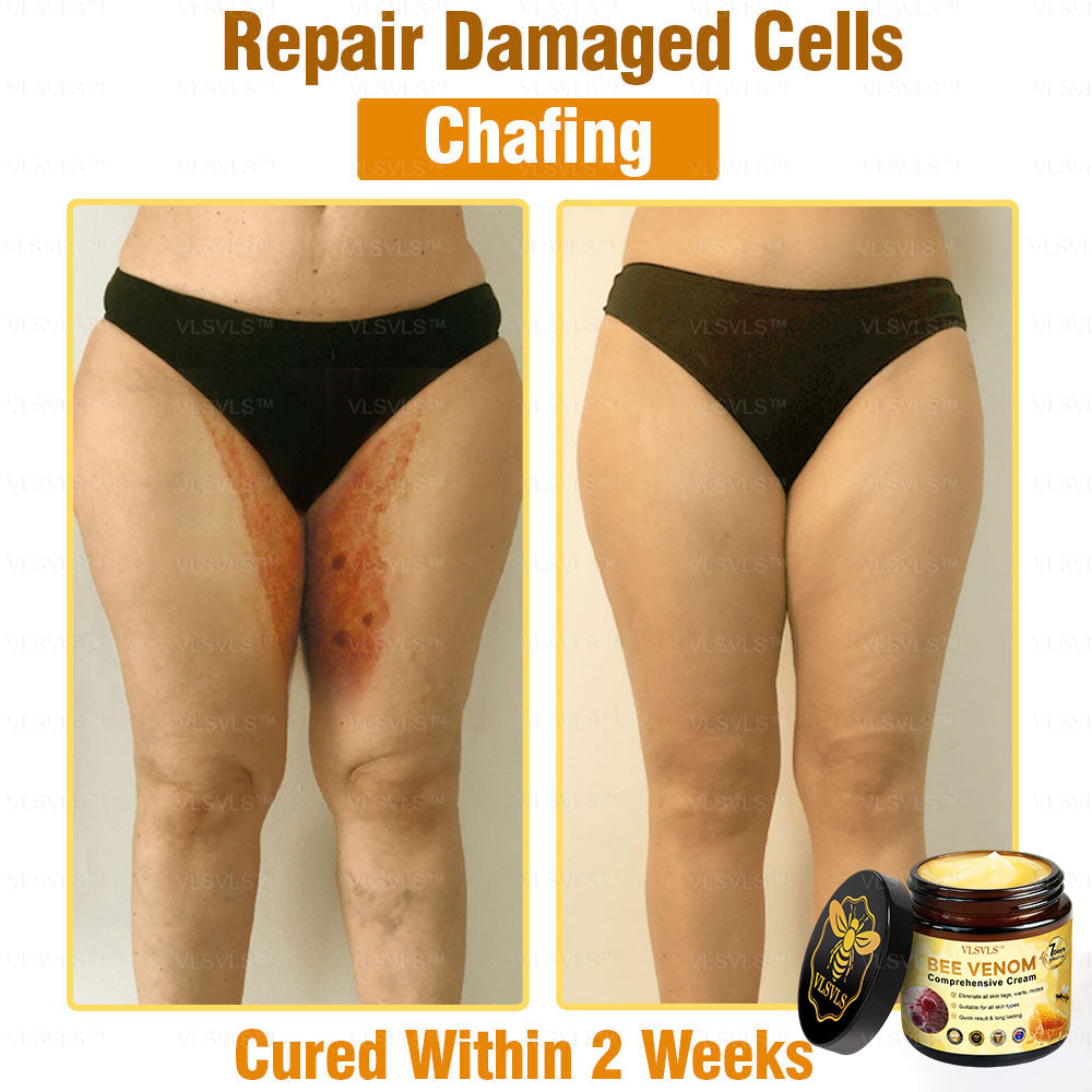 VLSVLS™ Bee Venom Comprehensive Cream 🎉🎉(Suitable for all ages & TGA recommends)