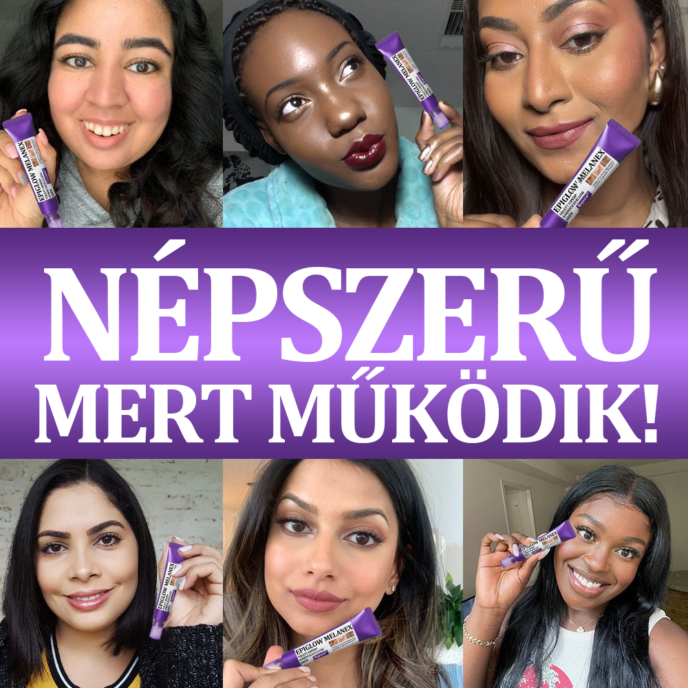 đ©·â
 EMMI minĆsĂtĂ©s| RopceerÂź đđđđđđđ đđđ„đđ§đđ PrĂ©mium arckrĂ©m