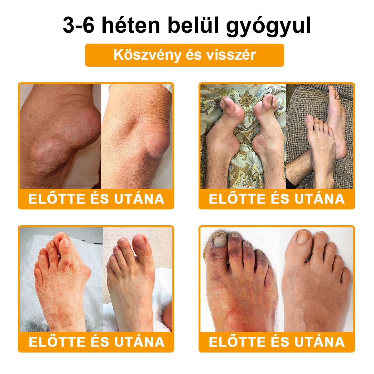 ✅TLOPA® Fájdalomcsillapító, csontregeneráló krém botulinum-toxinnal és méhméreggel 🐝