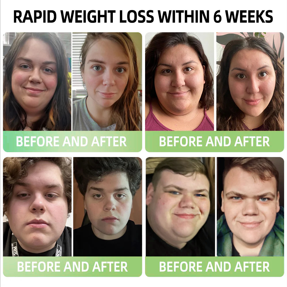 [Lose 10 kg quickly💡]𝐎𝐟𝐟𝐢𝐜𝐢𝐚𝐥 𝐓𝐡𝐨𝐧𝐞𝐬𝐫® 𝐒𝐭𝐨𝐫𝐞🇦🇺 𝐆𝐋𝐏-𝟏 𝐌𝐨𝐫𝐢𝐧𝐠𝐚 𝐒𝐥𝐢𝐦𝐦𝐢𝐧𝐠 & 𝐇𝐞𝐚𝐥𝐭𝐡 𝐁𝐨𝐨𝐬𝐭 𝐃𝐫𝐨𝐩𝐬( 👩‍⚕️𝐅𝐨𝐨𝐝-𝐠𝐫𝐚𝐝𝐞 𝐟𝐚𝐭 𝐛𝐮𝐫𝐧𝐞𝐫 – 𝐃𝐞𝐯𝐞𝐥𝐨𝐩𝐞𝐝 𝐛𝐲 𝐓𝐡𝐞 𝐎𝐛𝐞𝐬𝐢𝐭𝐲 𝐒𝐨𝐜𝐢𝐞𝐭𝐲) 💎