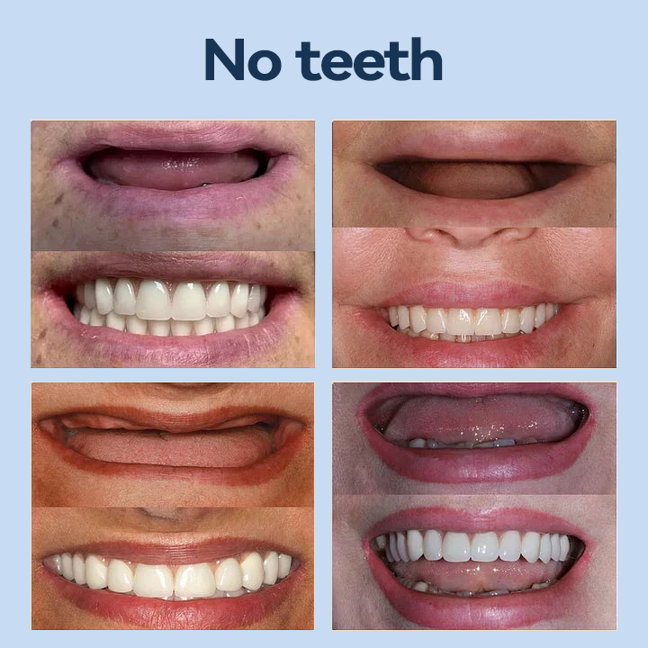 【Last Day Promotion 60% OFF🏆】 Bikenda® 𝐏𝐫𝐞𝐦𝐢𝐮𝐦 𝐃𝐞𝐧𝐭𝐮𝐫𝐞 - (✨Suitable for all mouth shapes, custom-made dentures for a perfect fit✨）