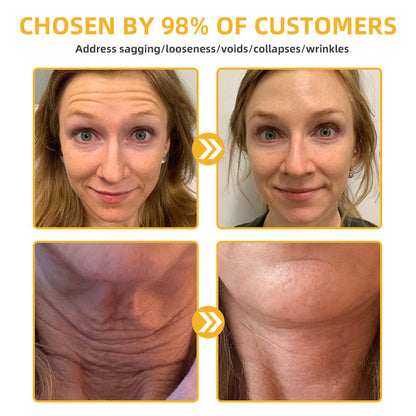 Bee Venom Retinol Skin Salve Ointment 📣BAD RECOMMENDS(🔥55% Off for a Limited Time!)