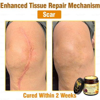 VLSVLS™ Bee Venom Comprehensive Cream 🎉🎉(Suitable for all ages & TGA recommends)