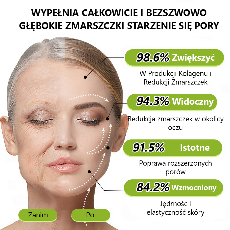 [🔥Last Day 70% OFF] Toclvo® Botox a vitamín A retinolová injekcia - Eraser for Deep Wrinkles, Sagging Jowls & Puffy Eyes