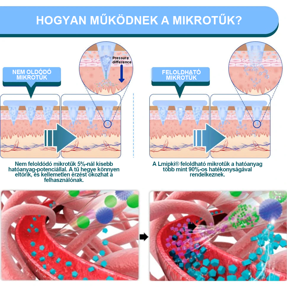[𝐋𝐦𝐢𝐩𝐤𝐢® Hivatalos áruház】👍Nano mikrotűs tapasz 𝐒𝐌𝐆𝐓-𝐆𝐋𝐏-𝟏-gyel és Mareixy-val | 3000-es karcsúsító, bőrfeszesítő