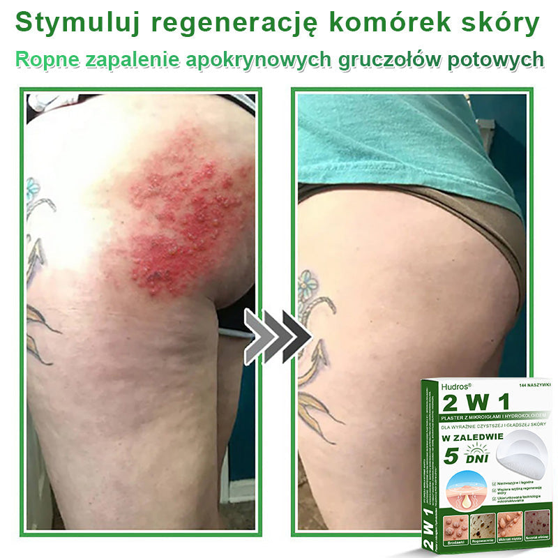 𝐇𝐮𝐝𝐫𝐨𝐬® 📌 𝐇𝐲𝐝𝐫𝐨ż𝐞𝐥𝐨𝐰𝐞 𝐩𝐥𝐚𝐬𝐭𝐫𝐲 𝐳 𝐦𝐢𝐤𝐫𝐨𝐢𝐠ł𝐚𝐦𝐢 𝟐 𝐰 𝟏 | 𝐒𝐩𝐞𝐜𝐣𝐚𝐥𝐧𝐢𝐞 𝐨𝐩𝐫𝐚𝐜𝐨𝐰𝐚𝐧𝐞 𝐝𝐨 𝐮𝐬𝐮𝐰𝐚𝐧𝐢𝐚 𝐰𝐲𝐩𝐮𝐤ł𝐲𝐜𝐡 𝐳𝐧𝐚𝐦𝐢𝐨𝐧, 𝐭𝐫ą𝐝𝐳𝐢𝐤𝐮, 𝐩ł𝐚𝐬𝐤𝐢𝐜𝐡 𝐛𝐫𝐨𝐝𝐚𝐰𝐞𝐤 𝐢 𝐳𝐦𝐢𝐚𝐧 𝐬𝐤ó𝐫𝐧𝐲𝐜𝐡 | 𝐎𝐩𝐚𝐤𝐨𝐰𝐚𝐧𝐢𝐞 𝟏𝟒𝟒 𝐬𝐳𝐭𝐮𝐤☘️☘️