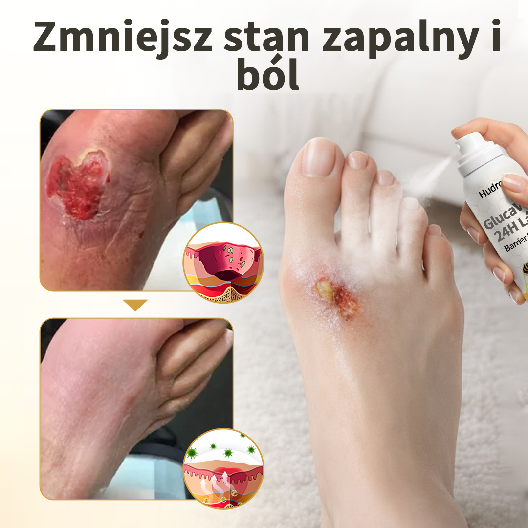 𝑯𝒖𝒅𝒓𝒐𝒔® 🧪 𝑮𝒍𝒖𝒄𝒂𝑽𝒆𝒊𝒍 24𝑯 𝒔𝒑𝒓𝒂𝒚 𝒐𝒄𝒉𝒓𝒐𝒏𝒏𝒚 𝒅𝒐 𝒔𝒕ó𝒑 ☘️