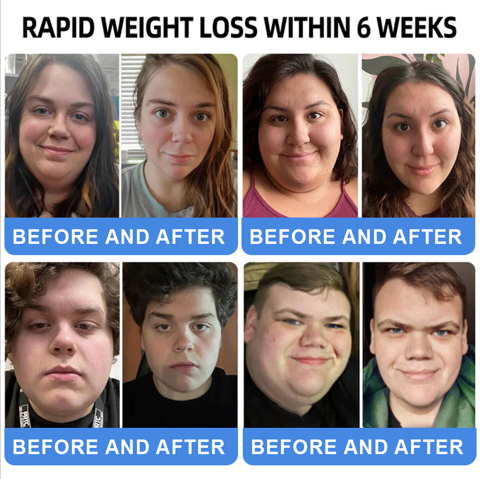 [Official Authorized Store] 💐𝐓𝐡𝐨𝐧𝐞𝐬𝐫®  GLP-1 Slimming & Health Ultra Concentrated Essence Liquid Pearls - NAD+ Moringa & ACV (✅speedy, long-lasting, addressing diabetes, obesity, and cardiovascular diseases) - ⚡Developed by the Obesity Society