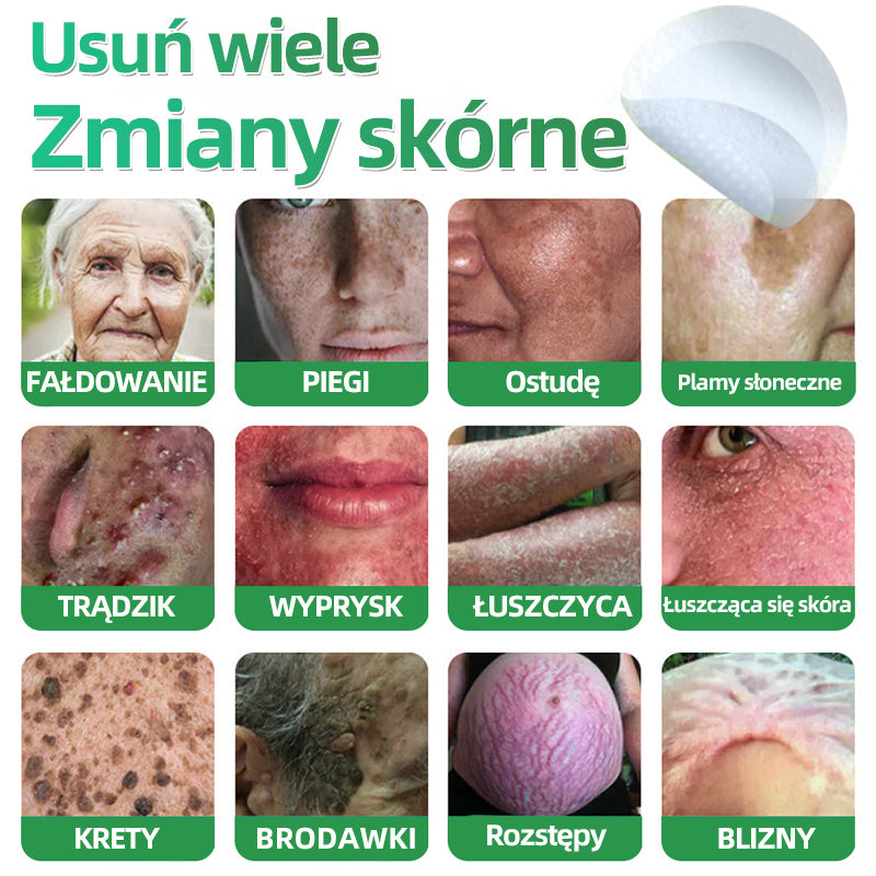 𝐇𝐮𝐝𝐫𝐨𝐬® 📌 𝐇𝐲𝐝𝐫𝐨ż𝐞𝐥𝐨𝐰𝐞 𝐩𝐥𝐚𝐬𝐭𝐫𝐲 𝐳 𝐦𝐢𝐤𝐫𝐨𝐢𝐠ł𝐚𝐦𝐢 𝟐 𝐰 𝟏 | 𝐒𝐩𝐞𝐜𝐣𝐚𝐥𝐧𝐢𝐞 𝐨𝐩𝐫𝐚𝐜𝐨𝐰𝐚𝐧𝐞 𝐝𝐨 𝐮𝐬𝐮𝐰𝐚𝐧𝐢𝐚 𝐰𝐲𝐩𝐮𝐤ł𝐲𝐜𝐡 𝐳𝐧𝐚𝐦𝐢𝐨𝐧, 𝐭𝐫ą𝐝𝐳𝐢𝐤𝐮, 𝐩ł𝐚𝐬𝐤𝐢𝐜𝐡 𝐛𝐫𝐨𝐝𝐚𝐰𝐞𝐤 𝐢 𝐳𝐦𝐢𝐚𝐧 𝐬𝐤ó𝐫𝐧𝐲𝐜𝐡 | 𝐎𝐩𝐚𝐤𝐨𝐰𝐚𝐧𝐢𝐞 𝟏𝟒𝟒 𝐬𝐳𝐭𝐮𝐤☘️☘️