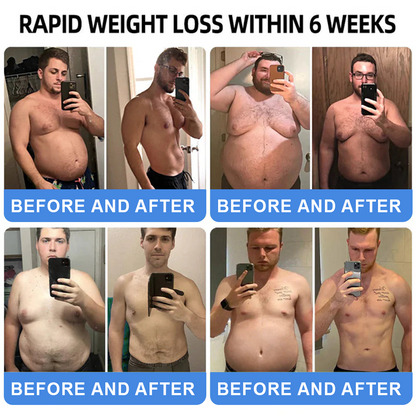 [Official Authorized Store] 💐𝐓𝐡𝐨𝐧𝐞𝐬𝐫®  GLP-1 Slimming & Health Ultra Concentrated Essence Liquid Pearls - NAD+ Moringa & ACV (✅speedy, long-lasting, addressing diabetes, obesity, and cardiovascular diseases) - ⚡Developed by the Obesity Society