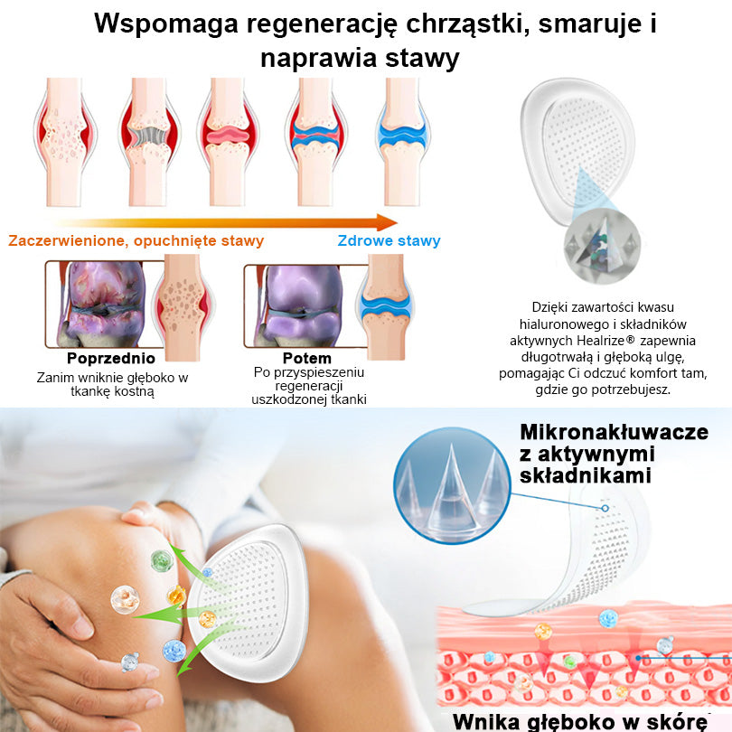 Oficjalny sklep：👨‍⚕️𝐇𝐞𝐚𝐥𝐫𝐢𝐳𝐞® Nano-wprowadzająca terapia stawów (bezbolesna, długotrwała, stosowana w przypadku zapalenia stawów, żylaków i różnych schorzeń ortopedycznych)