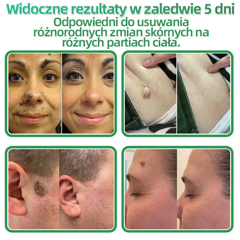 𝐇𝐮𝐝𝐫𝐨𝐬® 📌 𝐇𝐲𝐝𝐫𝐨ż𝐞𝐥𝐨𝐰𝐞 𝐩𝐥𝐚𝐬𝐭𝐫𝐲 𝐳 𝐦𝐢𝐤𝐫𝐨𝐢𝐠ł𝐚𝐦𝐢 𝟐 𝐰 𝟏 | 𝐒𝐩𝐞𝐜𝐣𝐚𝐥𝐧𝐢𝐞 𝐨𝐩𝐫𝐚𝐜𝐨𝐰𝐚𝐧𝐞 𝐝𝐨 𝐮𝐬𝐮𝐰𝐚𝐧𝐢𝐚 𝐰𝐲𝐩𝐮𝐤ł𝐲𝐜𝐡 𝐳𝐧𝐚𝐦𝐢𝐨𝐧, 𝐭𝐫ą𝐝𝐳𝐢𝐤𝐮, 𝐩ł𝐚𝐬𝐤𝐢𝐜𝐡 𝐛𝐫𝐨𝐝𝐚𝐰𝐞𝐤 𝐢 𝐳𝐦𝐢𝐚𝐧 𝐬𝐤ó𝐫𝐧𝐲𝐜𝐡 | 𝐎𝐩𝐚𝐤𝐨𝐰𝐚𝐧𝐢𝐞 𝟏𝟒𝟒 𝐬𝐳𝐭𝐮𝐤☘️☘️