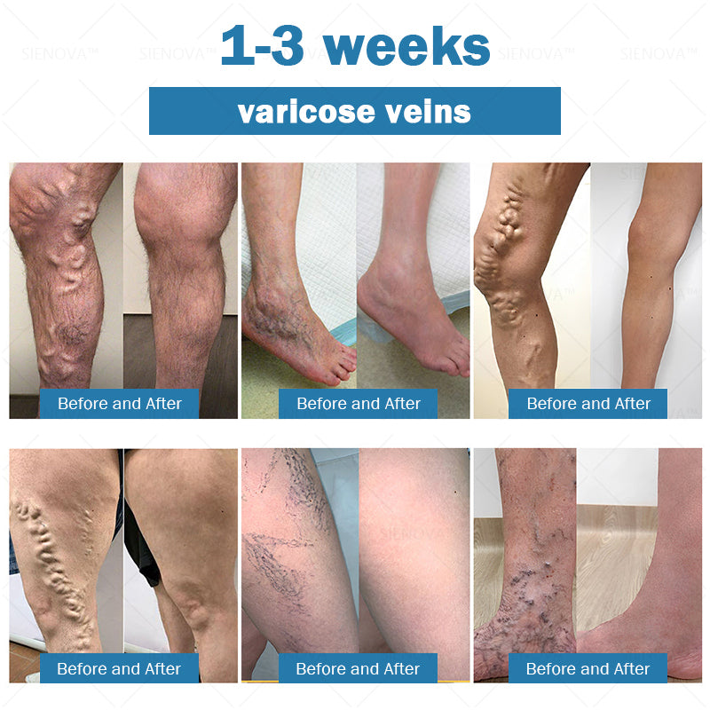 [Official Flagship  Store] 𝑪𝒓𝒐𝒂𝒊𝒆®🌠 𝗡𝗜𝗗𝗗𝗞-𝗧𝗶𝗿𝘇𝗲𝗽𝗮𝘁𝗶𝗱𝗲 & 𝗠𝗮𝘁𝗿𝗶𝘅𝘆𝗹 3000 𝑵𝒂𝒏𝒐 𝑴𝒊𝒄𝒓𝒐𝒏𝒆𝒆𝒅𝒍𝒆 𝑷𝒂𝒕𝒄𝒉 🇺🇸 | Painless  24/7 Release | Drop 20lbs Fast | Slash Blood Sugar by 90%