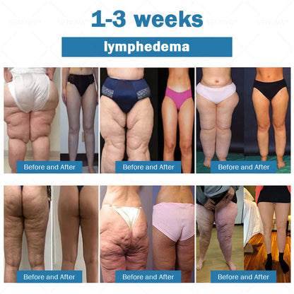 [Official Flagship  Store] 𝑪𝒓𝒐𝒂𝒊𝒆®🌠 𝗡𝗜𝗗𝗗𝗞-𝗧𝗶𝗿𝘇𝗲𝗽𝗮𝘁𝗶𝗱𝗲 & 𝗠𝗮𝘁𝗿𝗶𝘅𝘆𝗹 3000 𝑵𝒂𝒏𝒐 𝑴𝒊𝒄𝒓𝒐𝒏𝒆𝒆𝒅𝒍𝒆 𝑷𝒂𝒕𝒄𝒉 🇺🇸 | Painless  24/7 Release | Drop 20lbs Fast | Slash Blood Sugar by 90%