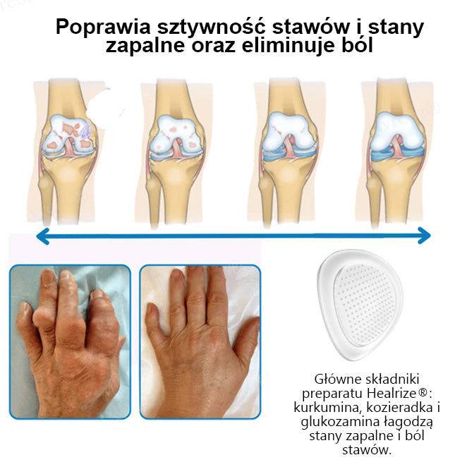 Oficjalny sklep：👨‍⚕️𝐇𝐞𝐚𝐥𝐫𝐢𝐳𝐞® Nano-wprowadzająca terapia stawów (bezbolesna, długotrwała, stosowana w przypadku zapalenia stawów, żylaków i różnych schorzeń ortopedycznych)