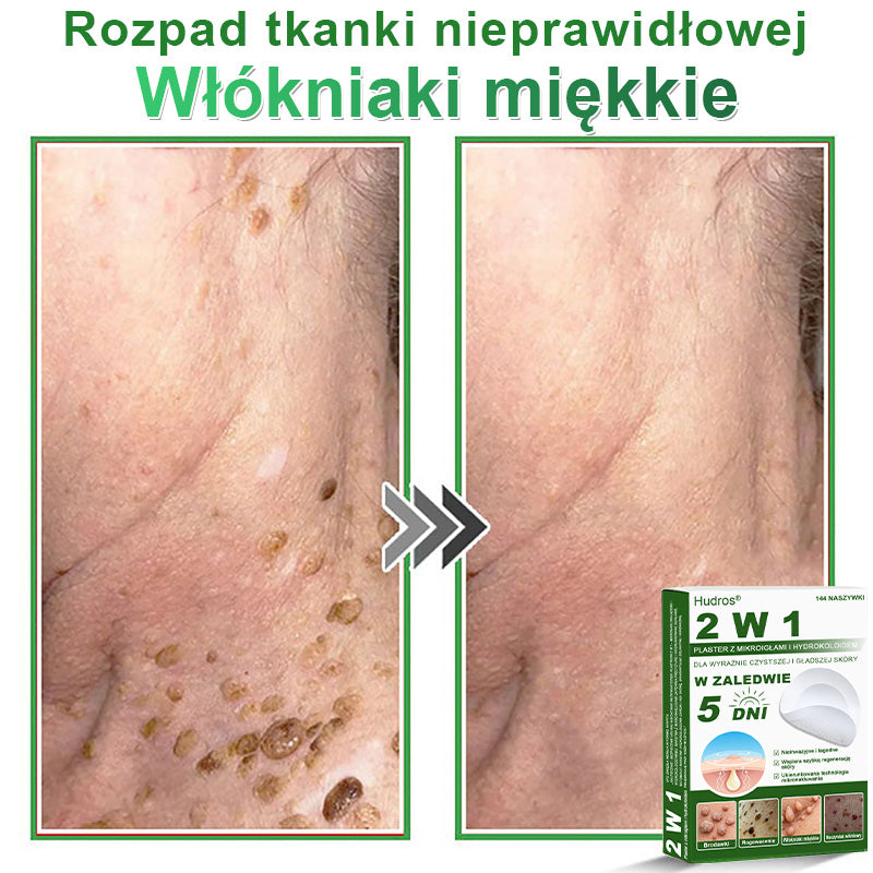 𝐇𝐮𝐝𝐫𝐨𝐬® 📌 𝐇𝐲𝐝𝐫𝐨ż𝐞𝐥𝐨𝐰𝐞 𝐩𝐥𝐚𝐬𝐭𝐫𝐲 𝐳 𝐦𝐢𝐤𝐫𝐨𝐢𝐠ł𝐚𝐦𝐢 𝟐 𝐰 𝟏 | 𝐒𝐩𝐞𝐜𝐣𝐚𝐥𝐧𝐢𝐞 𝐨𝐩𝐫𝐚𝐜𝐨𝐰𝐚𝐧𝐞 𝐝𝐨 𝐮𝐬𝐮𝐰𝐚𝐧𝐢𝐚 𝐰𝐲𝐩𝐮𝐤ł𝐲𝐜𝐡 𝐳𝐧𝐚𝐦𝐢𝐨𝐧, 𝐭𝐫ą𝐝𝐳𝐢𝐤𝐮, 𝐩ł𝐚𝐬𝐤𝐢𝐜𝐡 𝐛𝐫𝐨𝐝𝐚𝐰𝐞𝐤 𝐢 𝐳𝐦𝐢𝐚𝐧 𝐬𝐤ó𝐫𝐧𝐲𝐜𝐡 | 𝐎𝐩𝐚𝐤𝐨𝐰𝐚𝐧𝐢𝐞 𝟏𝟒𝟒 𝐬𝐳𝐭𝐮𝐤☘️☘️