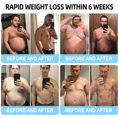 [Lmipki® Official Store】👨🏻‍⚕️𝐍𝐚𝐧𝐨 𝐌𝐢𝐜𝐫𝐨𝐧𝐞𝐞𝐝𝐥𝐞 𝐏𝐚𝐭𝐜𝐡 𝐰𝐢𝐭𝐡 𝐒𝐌𝐆𝐓-𝐆𝐋𝐏-𝟏&𝐌𝐚𝐭𝐫𝐢𝐱𝐲丨𝟑𝟎𝟎𝟎-𝐒𝐥𝐢𝐦𝐦𝐢𝐧𝐠, 𝐒𝐤𝐢𝐧 𝐓𝐢𝐠𝐡𝐭𝐞𝐧𝐢𝐧𝐠, 𝐁𝐥𝐨𝐨𝐝 𝐒𝐮𝐠𝐚𝐫 𝐒𝐮𝐩𝐩𝐨𝐫𝐭, 𝐍𝐨 𝐈𝐧𝐣𝐞𝐜𝐭𝐢𝐨𝐧, 𝟕-𝐃𝐚𝐲 𝐑𝐞𝐬𝐮𝐥𝐭