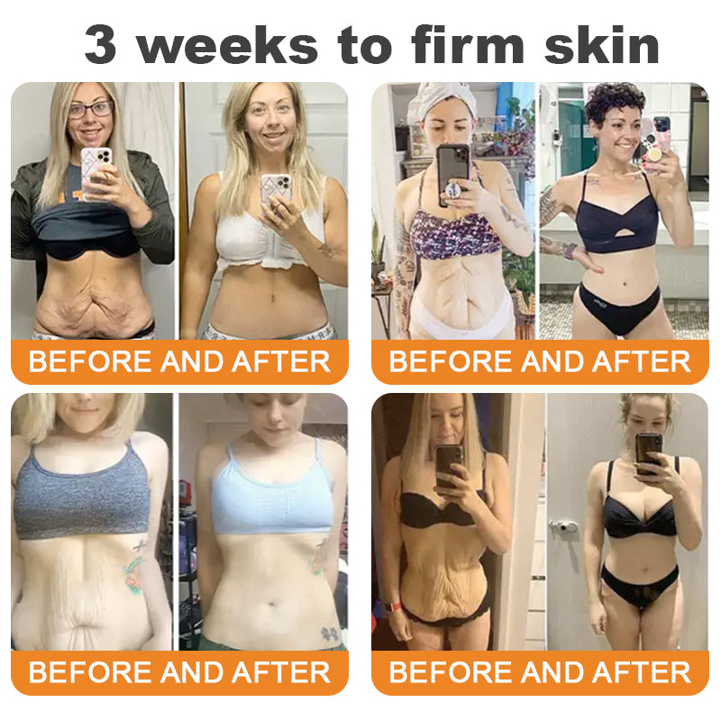 Made and Shipped from USA ✨ EQVP® Bee Venom Skin Restoration Cream ⏰ LAST DAY 80% OFF | 1.76 oz