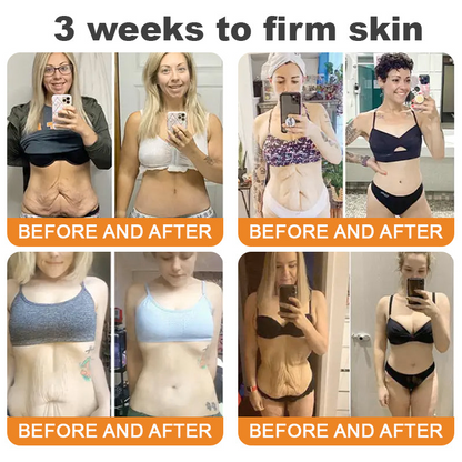 Made and Shipped from USA ✨ EQVP® Bee Venom Skin Restoration Cream ⏰ LAST DAY 80% OFF | 1.76 oz