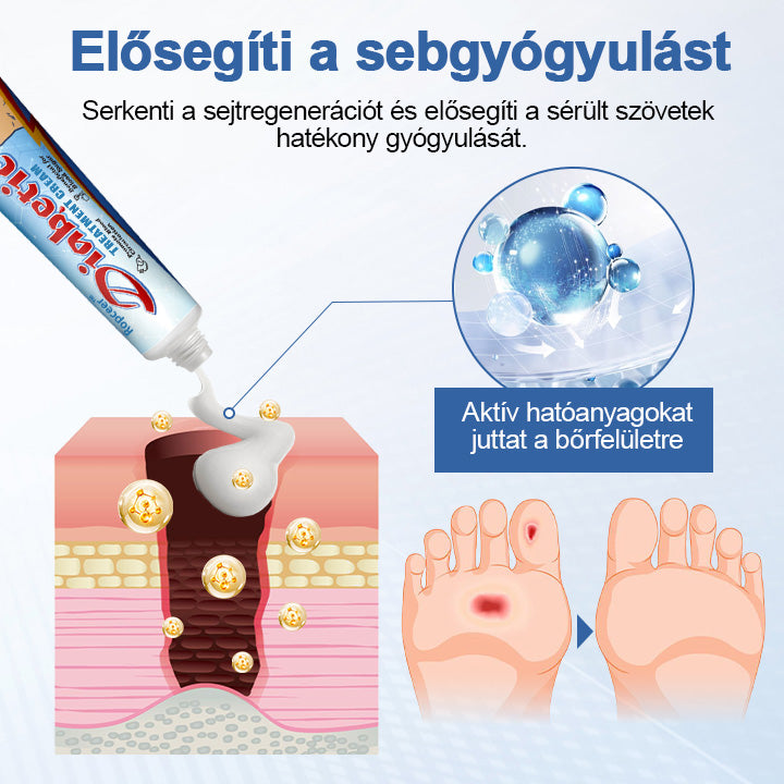 𝗥𝗼𝗽𝗰𝗲𝗲𝗿™ 𝗩𝗶𝘁𝗮𝗚𝗹𝘂𝗰𝗼 𝗖𝘂𝗸𝗼𝗿𝗯𝗲𝘁𝗲𝗴𝘀𝗲́𝗴𝗿𝗲 𝗦𝘇𝗮𝗸𝗼𝘀𝗼𝗱𝗼𝘁𝘁 𝗞𝗿𝗲́𝗺 🤩⚕️ Magyar Bőrgyógyászati Szövetség (MBSZ) által ajánlott🍀