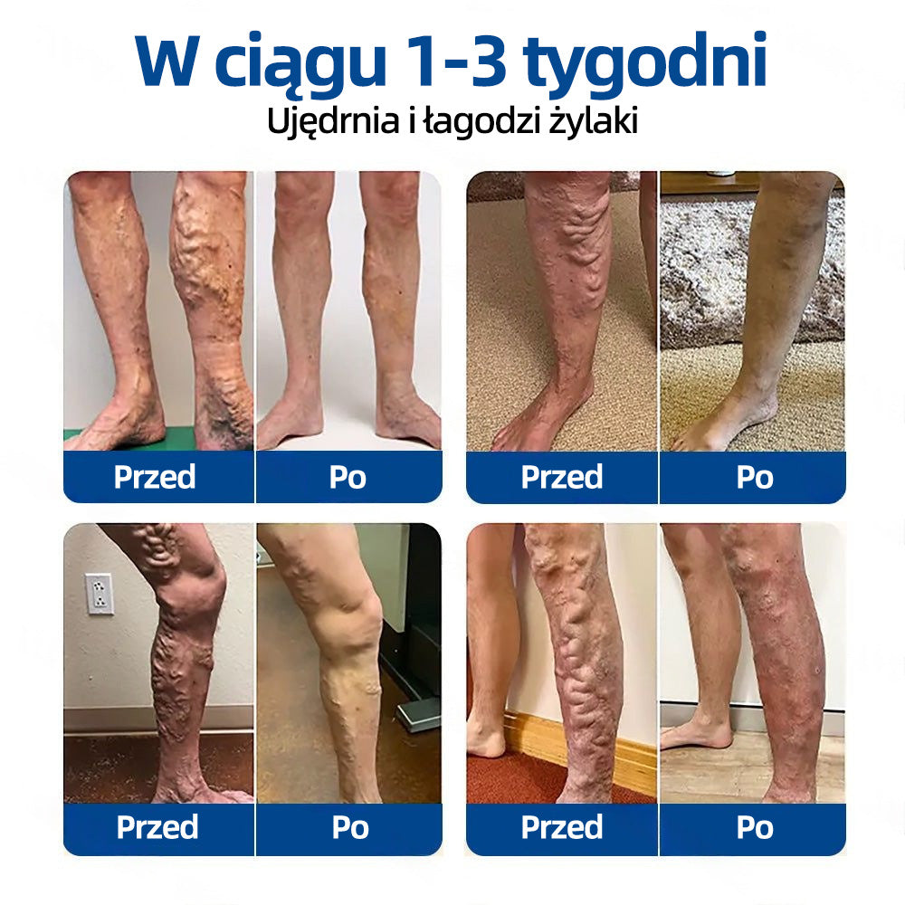 🇵🇱🥇✅ Healrize® VeinTarget Plaster z mikroigłami ⚡ Natychmiastowa ulga, długotrwałe efekty