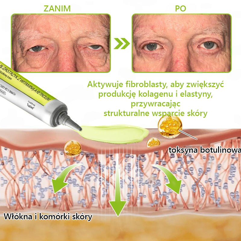 [🔥Last Day 70% OFF] Toclvo® Botox a vitamín A retinolová injekcia - Eraser for Deep Wrinkles, Sagging Jowls & Puffy Eyes