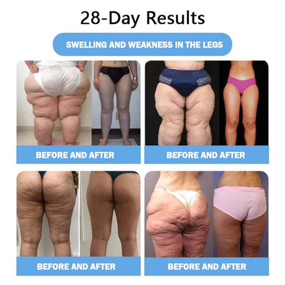 【Lmipki® Official Brand Store🇺🇸】 NIDDK-Tirzepatide Nano Microneedle Patch （Zero Pain, 24/7 Release | Lose 20lbs FAST | 90% Sugar Drop ）