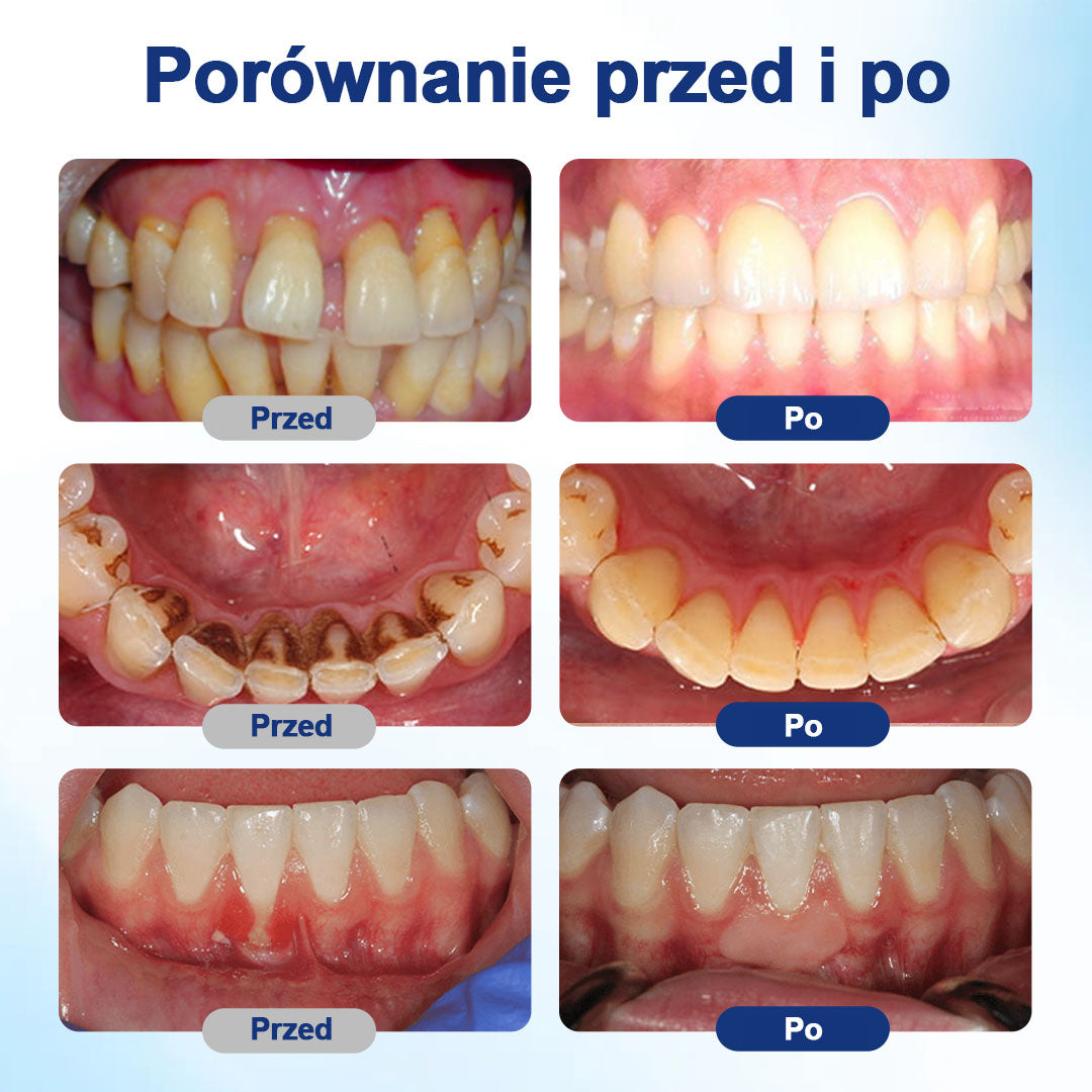 𝐇𝐄𝐀𝐓𝐖𝐎𝐋𝐅® 👩‍⚕️𝐁𝐞𝐞𝐓𝐚𝐤𝐭 𝐑𝐨𝐳𝐭𝐰ó𝐫 𝐝𝐨 𝐫𝐞𝐠𝐞𝐧𝐞𝐫𝐚𝐜𝐣𝐢 𝐣𝐚𝐦𝐲 𝐮𝐬𝐭𝐧𝐞𝐣🥒🥒