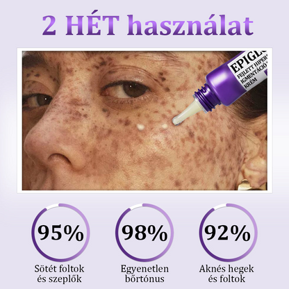 🩷✅ EMMI minősítés| Ropceer® 𝐄𝐏𝐈𝐆𝐋𝐎𝐖 𝐌𝐞𝐥𝐚𝐧𝐄𝐗 Prémium arckrém