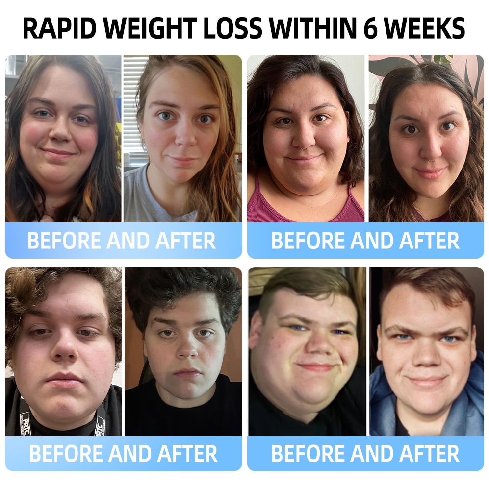 [Official Flagship  Store] 𝑪𝒓𝒐𝒂𝒊𝒆®🌠 𝗡𝗜𝗗𝗗𝗞-𝗧𝗶𝗿𝘇𝗲𝗽𝗮𝘁𝗶𝗱𝗲 & 𝗠𝗮𝘁𝗿𝗶𝘅𝘆𝗹 3000 𝑵𝒂𝒏𝒐 𝑴𝒊𝒄𝒓𝒐𝒏𝒆𝒆𝒅𝒍𝒆 𝑷𝒂𝒕𝒄𝒉 🇺🇸 | Painless  24/7 Release | Drop 20lbs Fast | Slash Blood Sugar by 90%