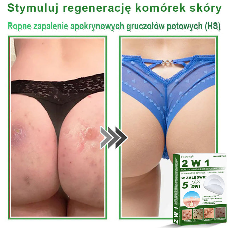 𝐇𝐮𝐝𝐫𝐨𝐬® 📌 𝐇𝐲𝐝𝐫𝐨ż𝐞𝐥𝐨𝐰𝐞 𝐩𝐥𝐚𝐬𝐭𝐫𝐲 𝐳 𝐦𝐢𝐤𝐫𝐨𝐢𝐠ł𝐚𝐦𝐢 𝟐 𝐰 𝟏 | 𝐒𝐩𝐞𝐜𝐣𝐚𝐥𝐧𝐢𝐞 𝐨𝐩𝐫𝐚𝐜𝐨𝐰𝐚𝐧𝐞 𝐝𝐨 𝐮𝐬𝐮𝐰𝐚𝐧𝐢𝐚 𝐰𝐲𝐩𝐮𝐤ł𝐲𝐜𝐡 𝐳𝐧𝐚𝐦𝐢𝐨𝐧, 𝐭𝐫ą𝐝𝐳𝐢𝐤𝐮, 𝐩ł𝐚𝐬𝐤𝐢𝐜𝐡 𝐛𝐫𝐨𝐝𝐚𝐰𝐞𝐤 𝐢 𝐳𝐦𝐢𝐚𝐧 𝐬𝐤ó𝐫𝐧𝐲𝐜𝐡 | 𝐎𝐩𝐚𝐤𝐨𝐰𝐚𝐧𝐢𝐞 𝟏𝟒𝟒 𝐬𝐳𝐭𝐮𝐤☘️☘️