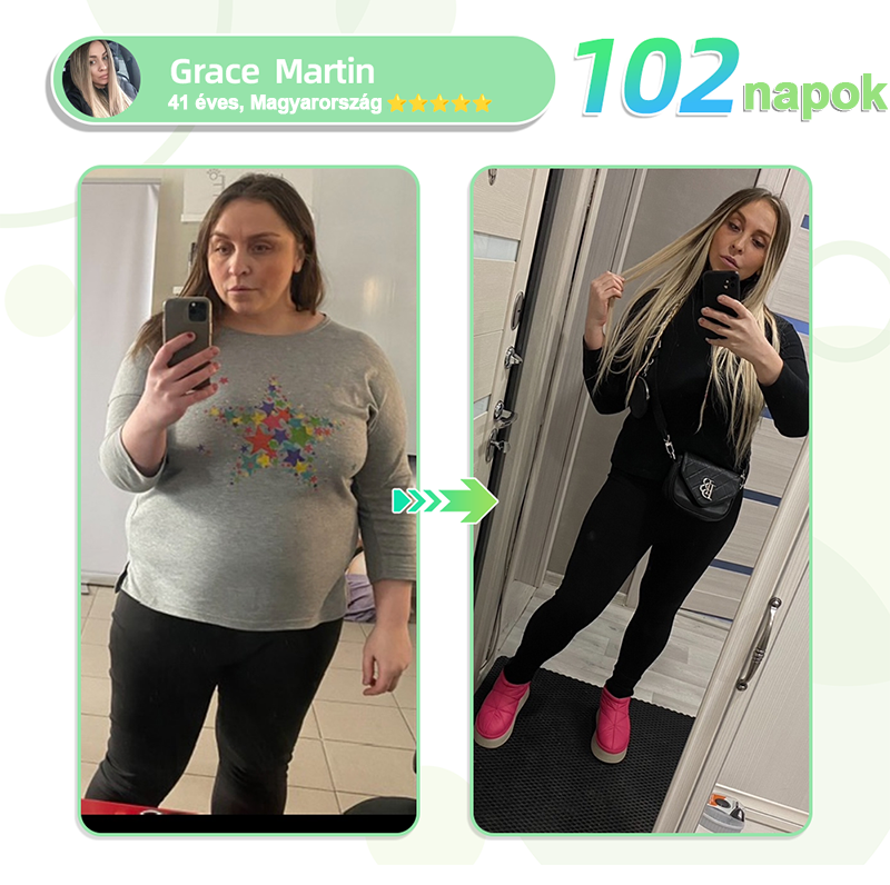 Cvreoz™ Smgt-Glp-1 Nano Microneedle Tapaszok (Fájdalommentes, hosszan tartó, a cukorbetegség, az elhízás és a szív- és érrendszeri betegségek kezelésére)👨‍⚕️