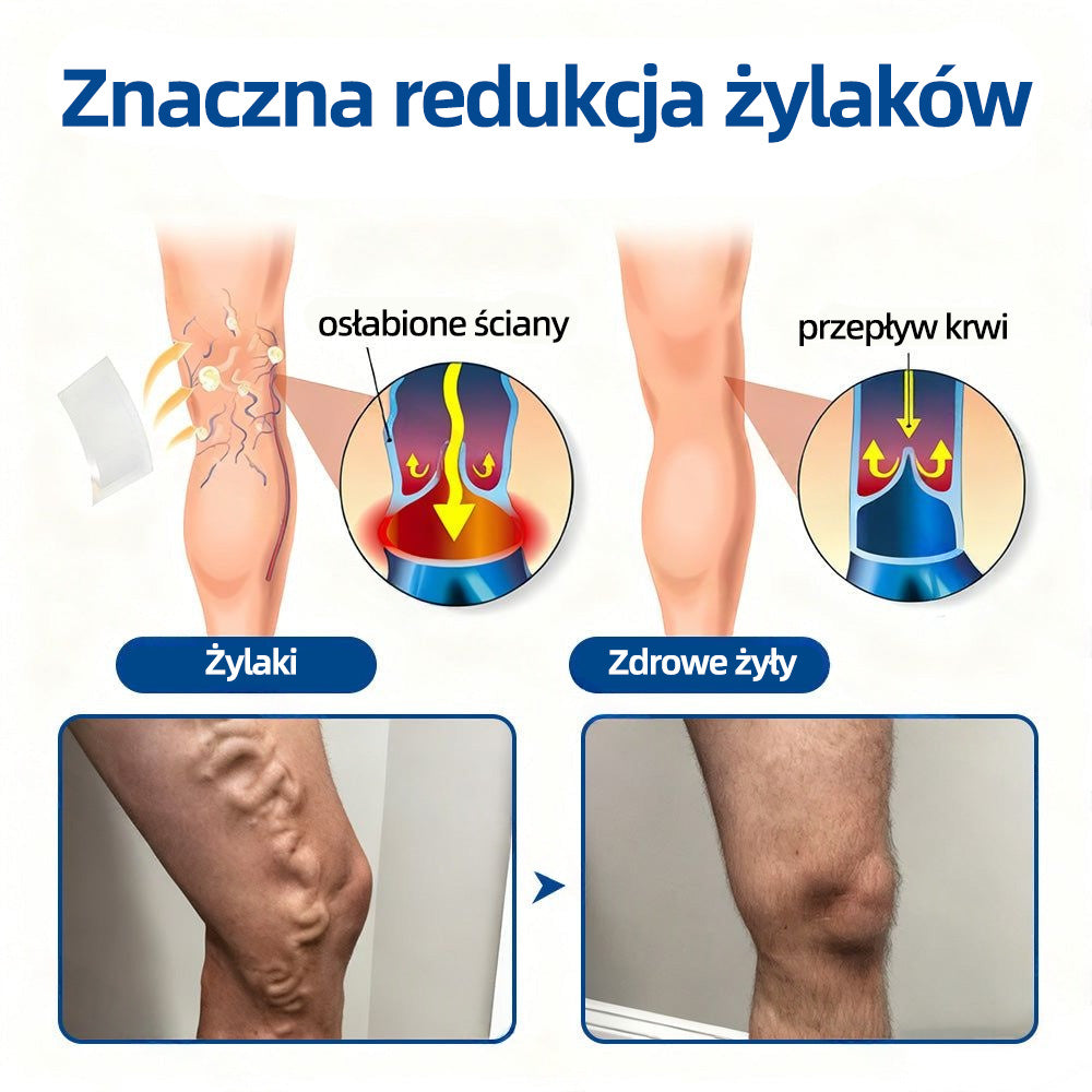 🇵🇱🥇✅ Healrize® VeinTarget Plaster z mikroigłami ⚡ Natychmiastowa ulga, długotrwałe efekty