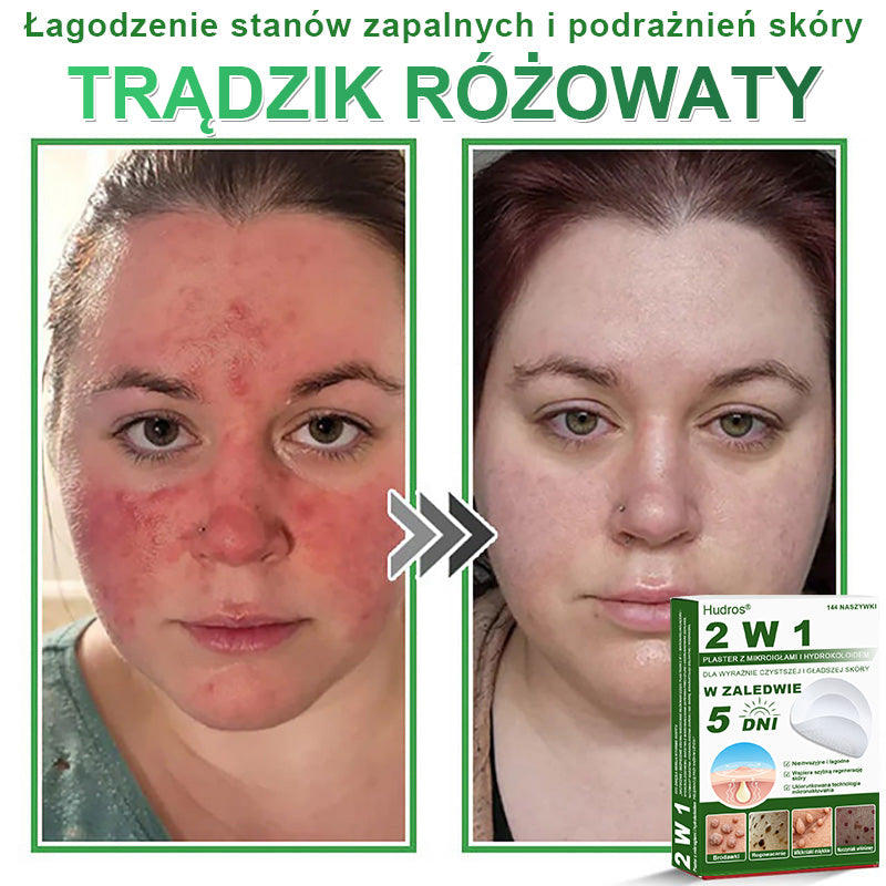𝐇𝐮𝐝𝐫𝐨𝐬® 📌 𝐇𝐲𝐝𝐫𝐨ż𝐞𝐥𝐨𝐰𝐞 𝐩𝐥𝐚𝐬𝐭𝐫𝐲 𝐳 𝐦𝐢𝐤𝐫𝐨𝐢𝐠ł𝐚𝐦𝐢 𝟐 𝐰 𝟏 | 𝐒𝐩𝐞𝐜𝐣𝐚𝐥𝐧𝐢𝐞 𝐨𝐩𝐫𝐚𝐜𝐨𝐰𝐚𝐧𝐞 𝐝𝐨 𝐮𝐬𝐮𝐰𝐚𝐧𝐢𝐚 𝐰𝐲𝐩𝐮𝐤ł𝐲𝐜𝐡 𝐳𝐧𝐚𝐦𝐢𝐨𝐧, 𝐭𝐫ą𝐝𝐳𝐢𝐤𝐮, 𝐩ł𝐚𝐬𝐤𝐢𝐜𝐡 𝐛𝐫𝐨𝐝𝐚𝐰𝐞𝐤 𝐢 𝐳𝐦𝐢𝐚𝐧 𝐬𝐤ó𝐫𝐧𝐲𝐜𝐡 | 𝐎𝐩𝐚𝐤𝐨𝐰𝐚𝐧𝐢𝐞 𝟏𝟒𝟒 𝐬𝐳𝐭𝐮𝐤☘️☘️