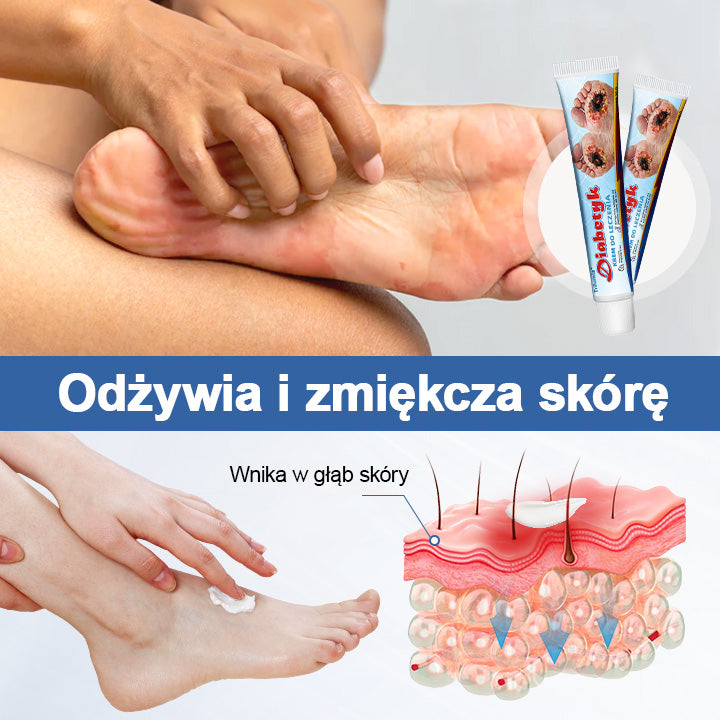Trilumia® Diabetyk Krem leczniczy -🌱Zatwierdzone przez Polskie Towarzystwo Diabetologiczne oraz certyfikowane przez AAD🌱