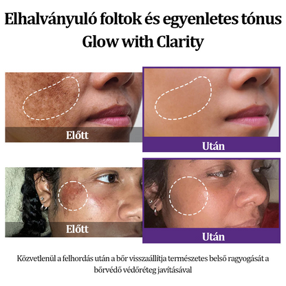 🩷✅ EMMI minősítés| Ropceer® 𝐄𝐏𝐈𝐆𝐋𝐎𝐖 𝐌𝐞𝐥𝐚𝐧𝐄𝐗 Prémium arckrém