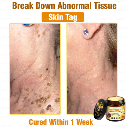 VLSVLS™ Bee Venom Comprehensive Cream 🎉🎉(Suitable for all ages & TGA recommends)