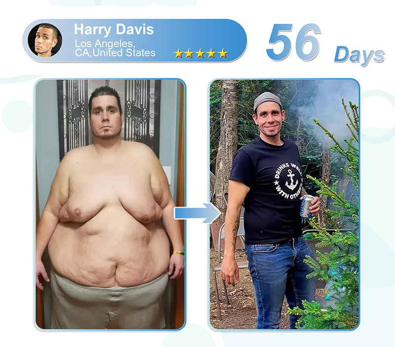 [Official Authorized Store] 💐𝐓𝐡𝐨𝐧𝐞𝐬𝐫®  GLP-1 Slimming & Health Ultra Concentrated Essence Liquid Pearls - NAD+ Moringa & ACV (✅speedy, long-lasting, addressing diabetes, obesity, and cardiovascular diseases) - ⚡Developed by the Obesity Society