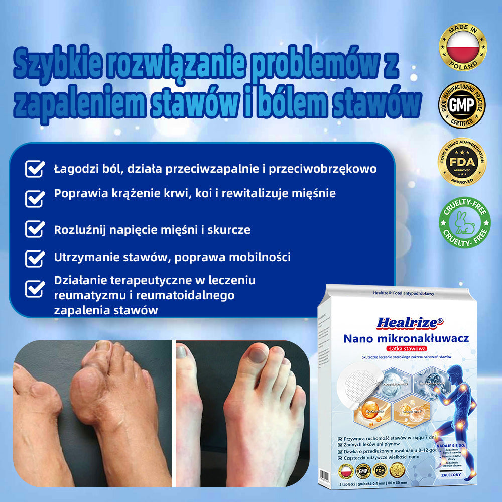 Oficjalny sklep：👨‍⚕️𝐇𝐞𝐚𝐥𝐫𝐢𝐳𝐞® Nano-wprowadzająca terapia stawów (bezbolesna, długotrwała, stosowana w przypadku zapalenia stawów, żylaków i różnych schorzeń ortopedycznych)