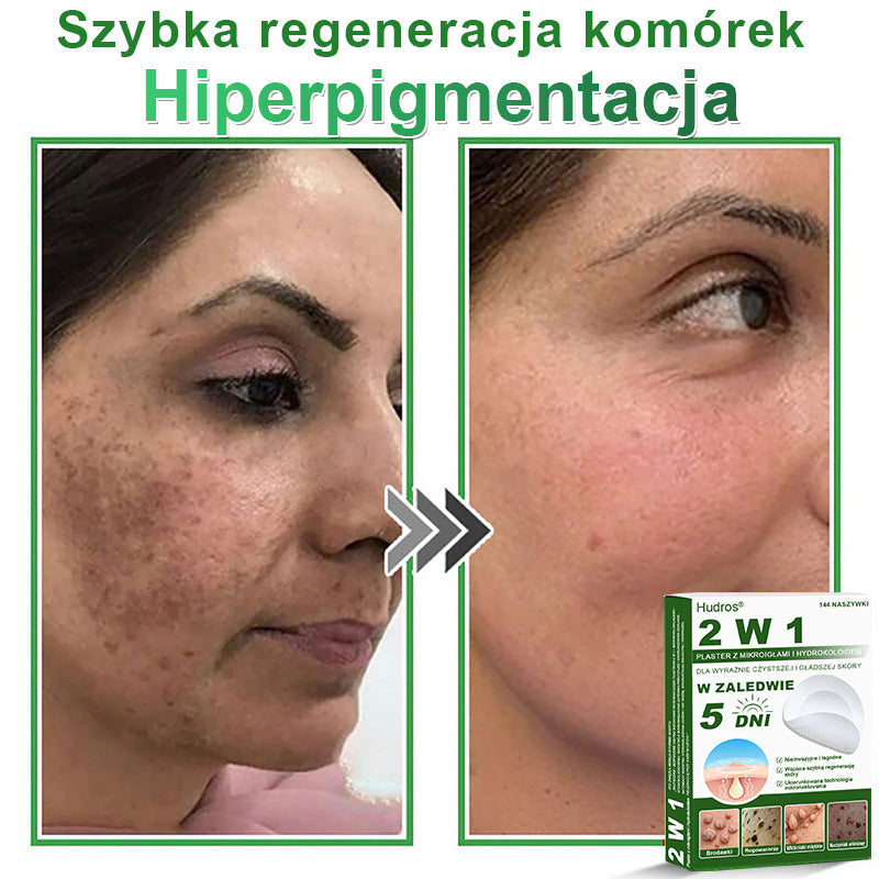 𝐇𝐮𝐝𝐫𝐨𝐬® 📌 𝐇𝐲𝐝𝐫𝐨ż𝐞𝐥𝐨𝐰𝐞 𝐩𝐥𝐚𝐬𝐭𝐫𝐲 𝐳 𝐦𝐢𝐤𝐫𝐨𝐢𝐠ł𝐚𝐦𝐢 𝟐 𝐰 𝟏 | 𝐒𝐩𝐞𝐜𝐣𝐚𝐥𝐧𝐢𝐞 𝐨𝐩𝐫𝐚𝐜𝐨𝐰𝐚𝐧𝐞 𝐝𝐨 𝐮𝐬𝐮𝐰𝐚𝐧𝐢𝐚 𝐰𝐲𝐩𝐮𝐤ł𝐲𝐜𝐡 𝐳𝐧𝐚𝐦𝐢𝐨𝐧, 𝐭𝐫ą𝐝𝐳𝐢𝐤𝐮, 𝐩ł𝐚𝐬𝐤𝐢𝐜𝐡 𝐛𝐫𝐨𝐝𝐚𝐰𝐞𝐤 𝐢 𝐳𝐦𝐢𝐚𝐧 𝐬𝐤ó𝐫𝐧𝐲𝐜𝐡 | 𝐎𝐩𝐚𝐤𝐨𝐰𝐚𝐧𝐢𝐞 𝟏𝟒𝟒 𝐬𝐳𝐭𝐮𝐤☘️☘️