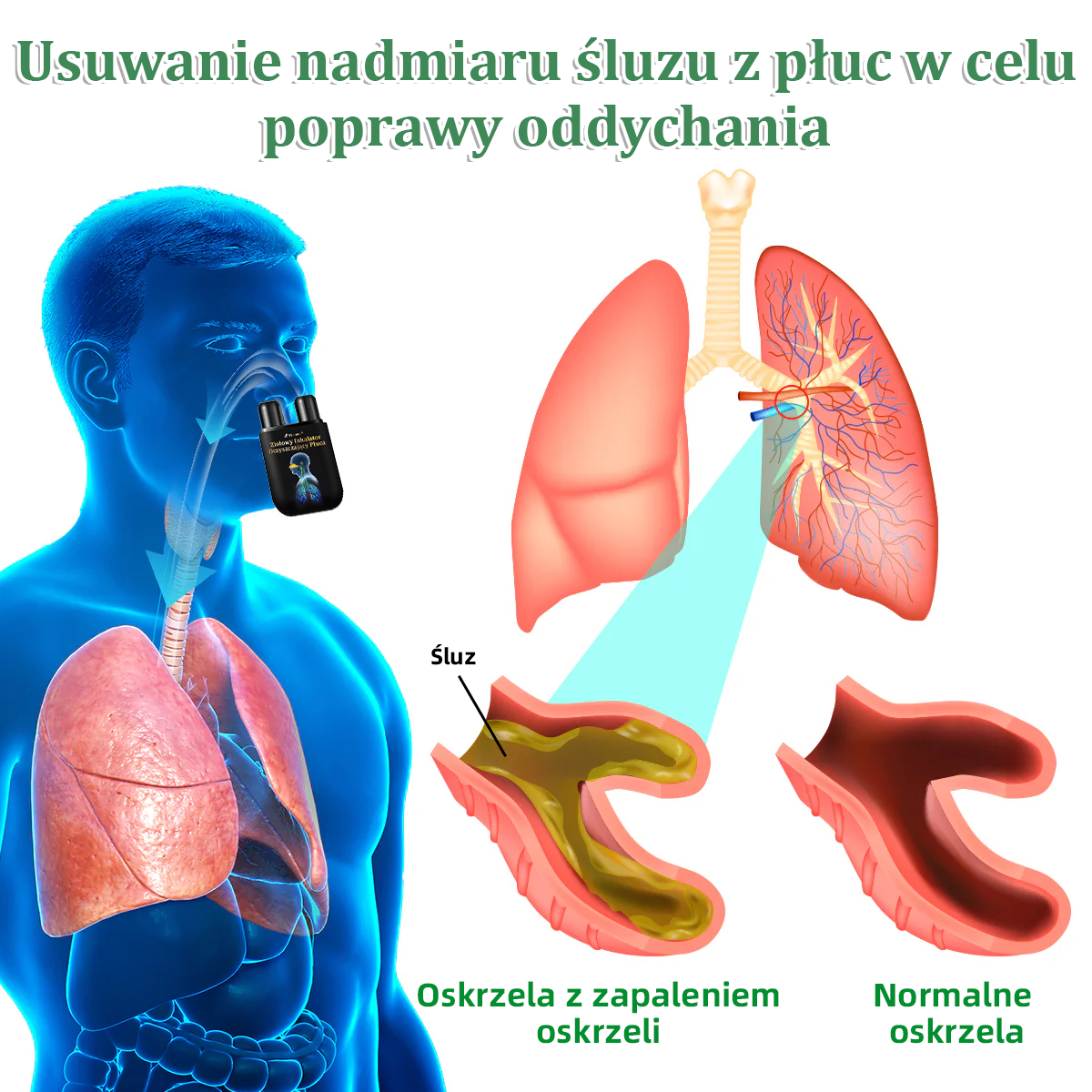Oficjalny sklep💝✅:Thonesr® Ziołowy Inhalator Oczyszczający Płuca  🫁Zatwierdzony przez URPL(💝 kaszel, świszczący oddech, duszność, plwocina, zatkany nos, zapalenie oskrzeli, zapalenie oskrzeli, objawy alergii, dyskomfort w płucach💝)👩‍⚕️